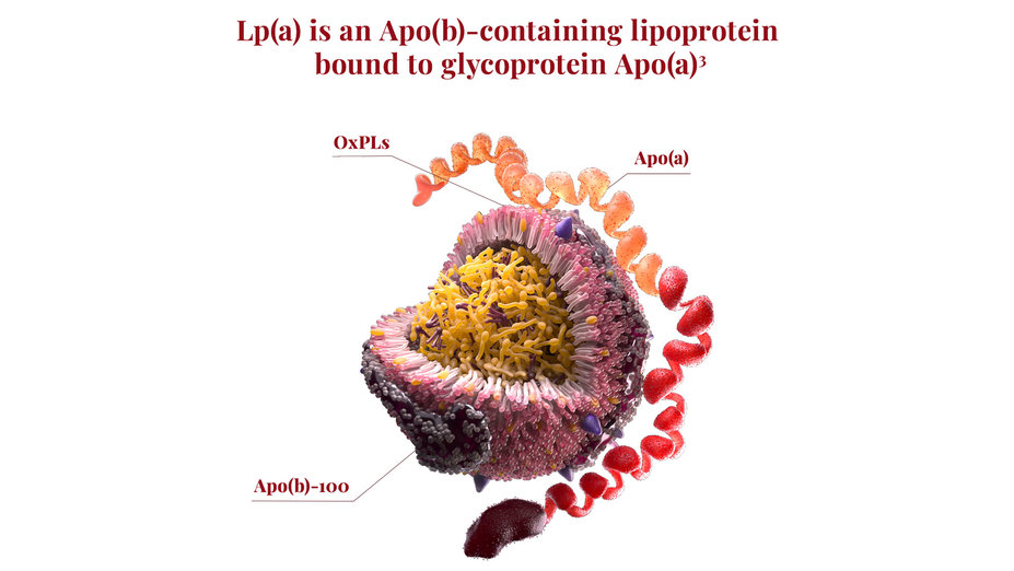 Lp(a) is an ApoB-containing lipoprotein bound to glycoprotein Apo(a).
